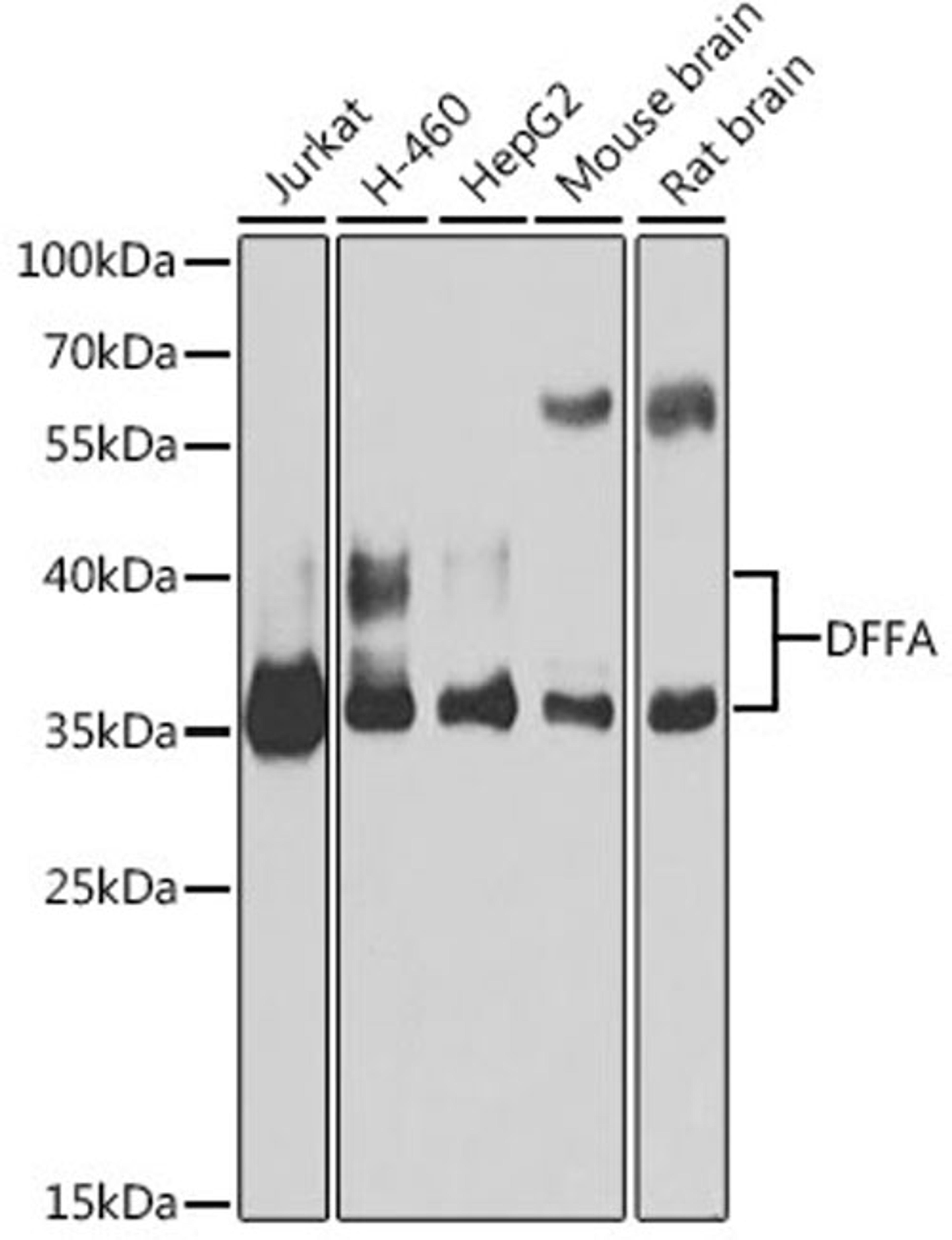 Western blot - DFFA antibody (A1032)