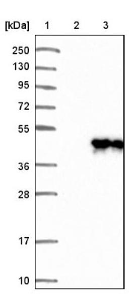 Western Blot: NAPG Antibody [NBP1-86491] - Lane 1: Marker [kDa] 250, 130, 95, 72, 55, 36, 28, 17, 10<br/>Lane 2: Negative control (vector only transfected HEK293T lysate)<br/>Lane 3: Over-expression lysate (Co-expressed with a C-terminal myc-DDK tag (~3.1 kDa) in mammalian HEK293T cells, LY418393)