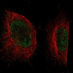 Immunocytochemistry/Immunofluorescence: LRRC8A Antibody [NBP1-84636] - Staining of human cell line U-251MG shows positivity in nuclei but not nucleoli.