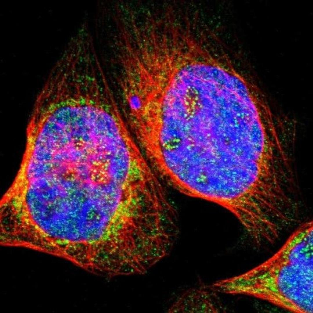 Immunocytochemistry/Immunofluorescence: ERICH1 Antibody [NBP1-90952] - Staining of human cell line A-431 shows positivity in nucleus, nucleoli & mitochondria.