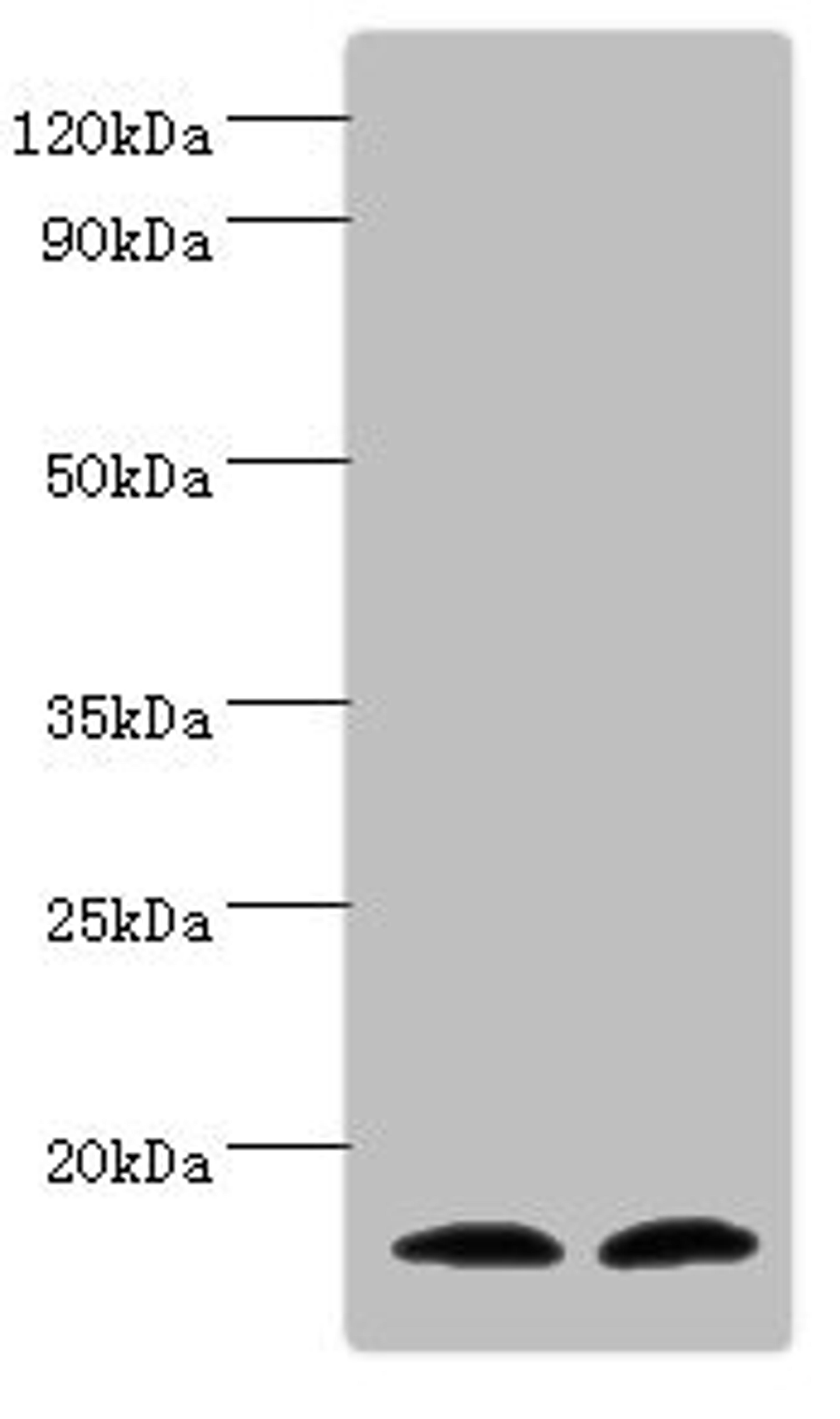 Western blot. All lanes: Protachykinin-1 antibody at 6ug/ml. Lane 1: Mouse liver tissue. Lane 2: 293T whole cell lysate. Secondary. Goat polyclonal to rabbit IgG at 1/10000 dilution. Predicted band size: 16, 14, 12 kDa. Observed band size: 16 kDa.