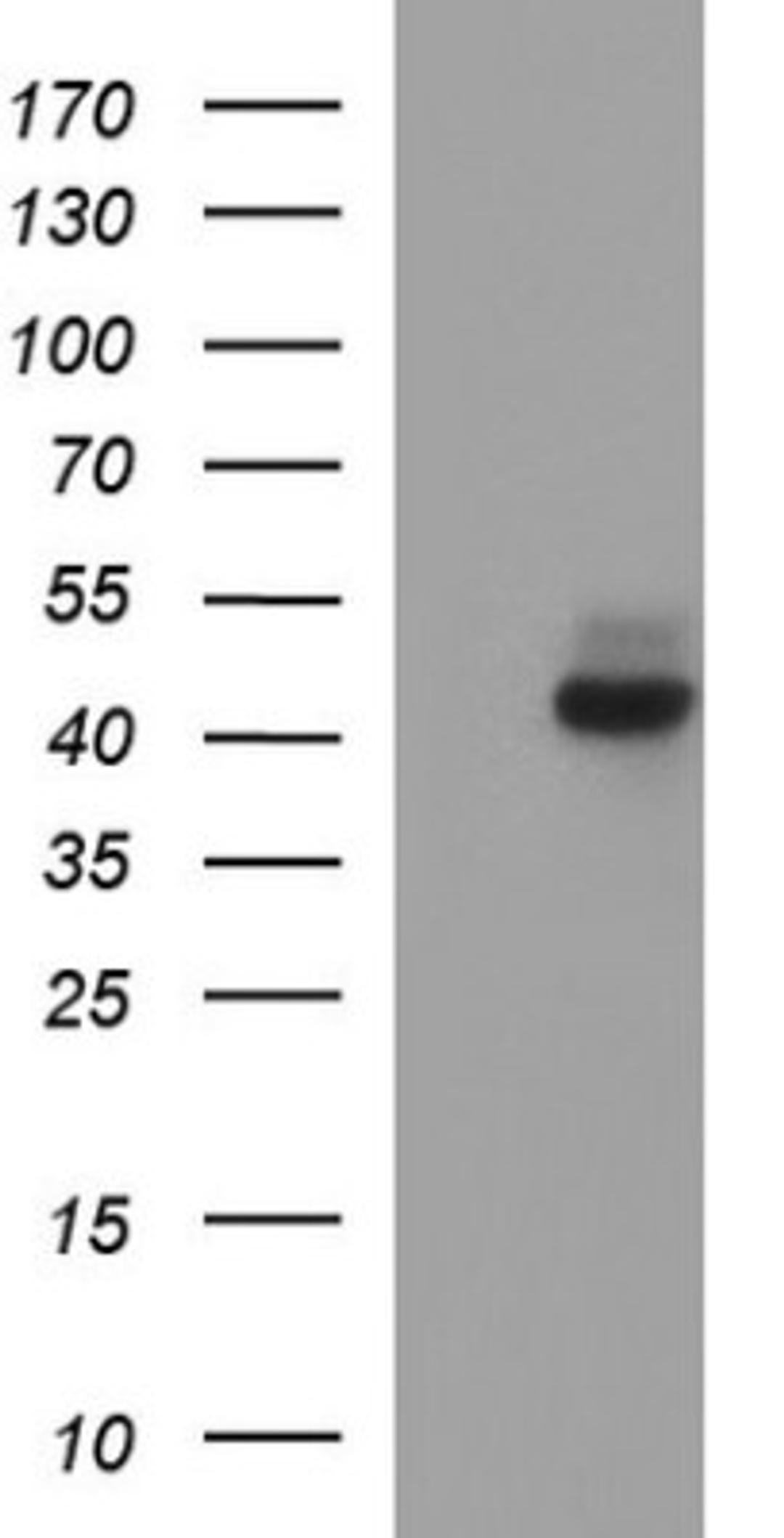 Western Blot: Necdin Antibody (5D1) [NBP2-46117] - Analysis of HEK293T cells were transfected with the pCMV6-ENTRY control (Left lane) or pCMV6-ENTRY Necdin.