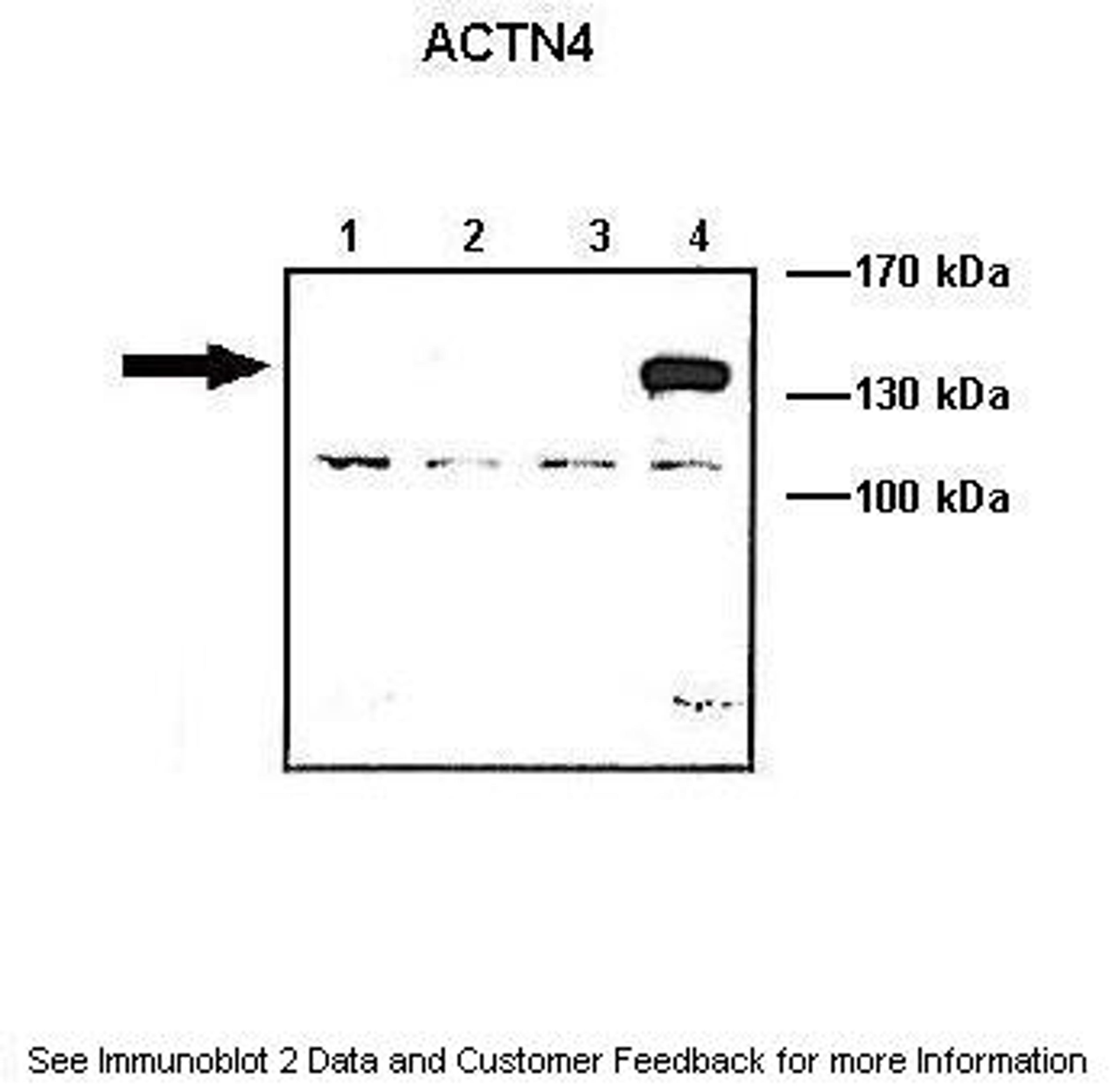 Antibody used in WB on ACTNX-GFP transfected at: 1:1000 (Lane1: 10 ug ACTN1-GFP transfected COS-7 lysate, Lane2: 10 ug ACTN2-GFP transfected COS-7 lysate, Lane3: 10 ug ACTN3-GFP transfected COS-7 lysate, Lane4: 10 ug ACTN4-GFP transfected COS-7 lysate).