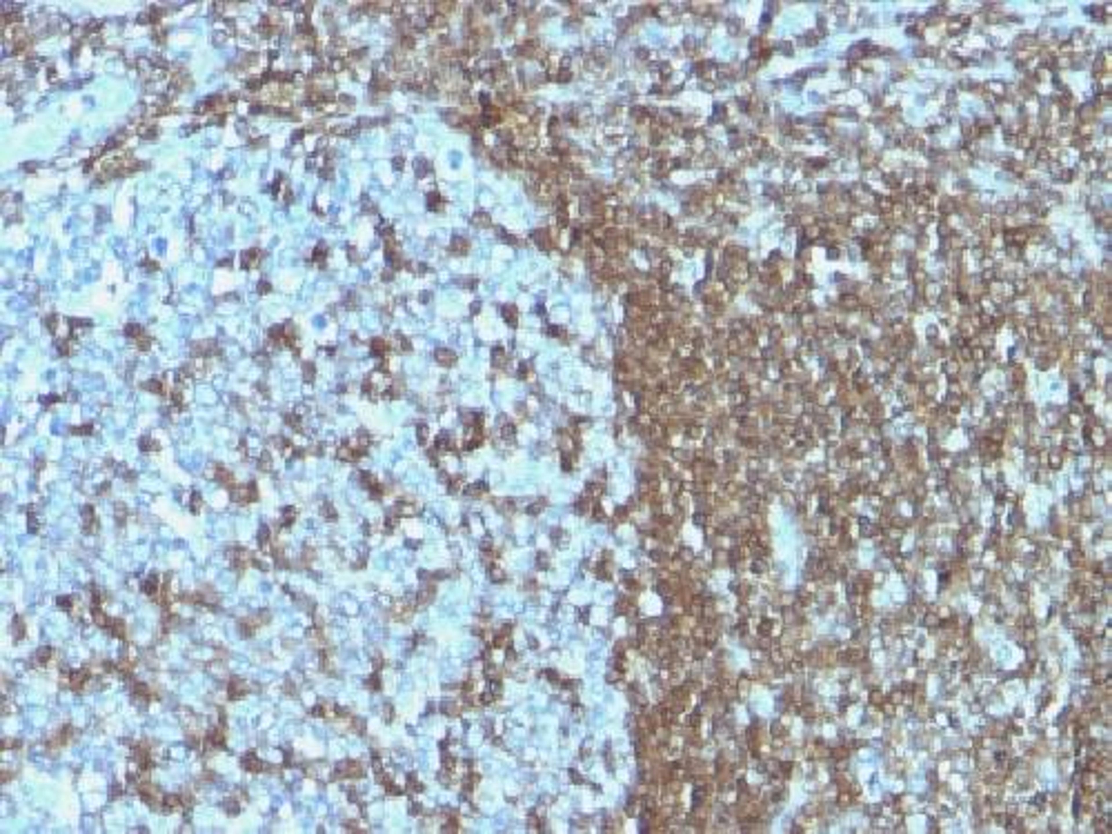 Immunohistochemical staining of human Tonsil tissue using ICAM3 antibody