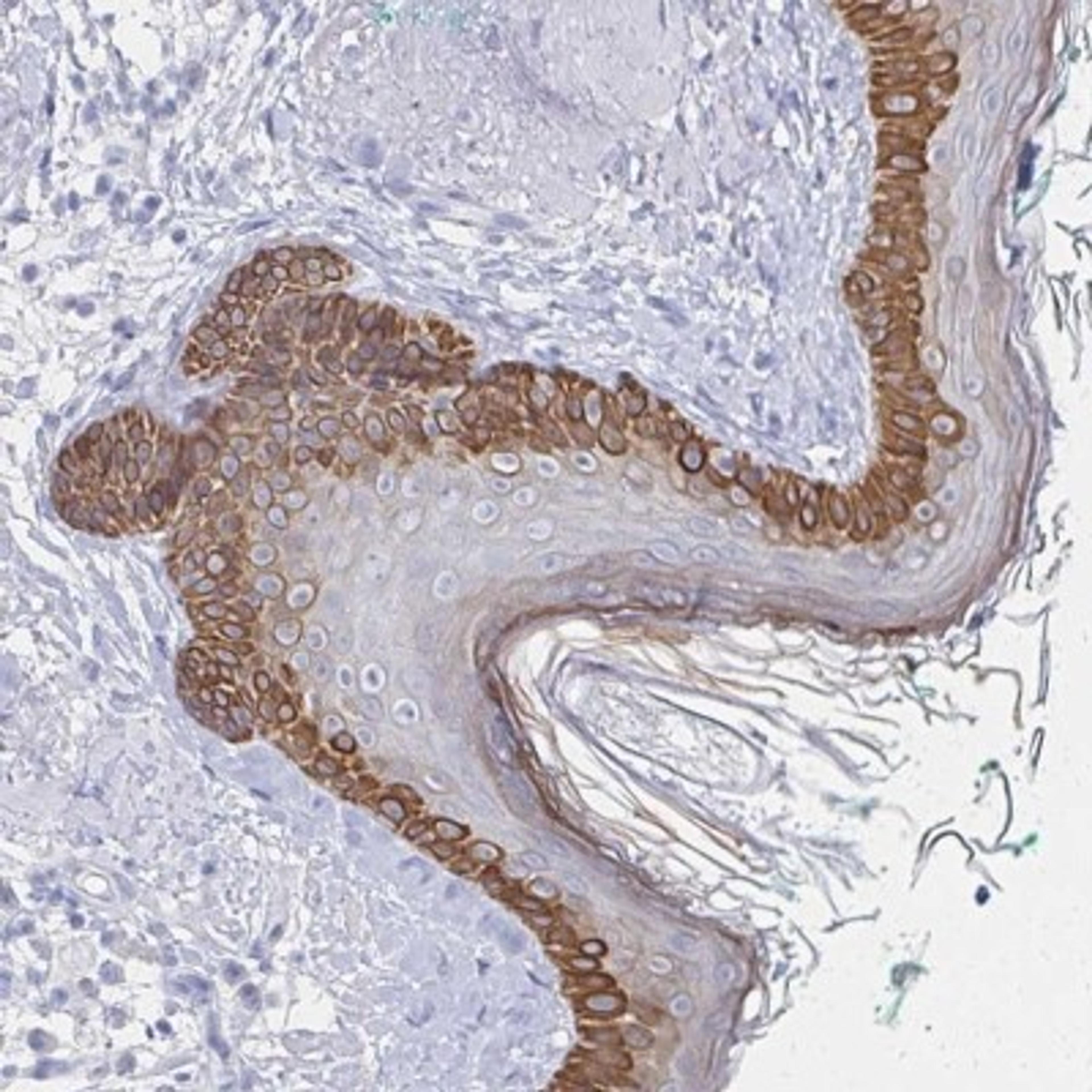 Immunohistochemistry: KRT6L Antibody [NBP2-31764] - Staining of human skin shows strong cytoplasmic positivity in basal cells of keratinocytes.