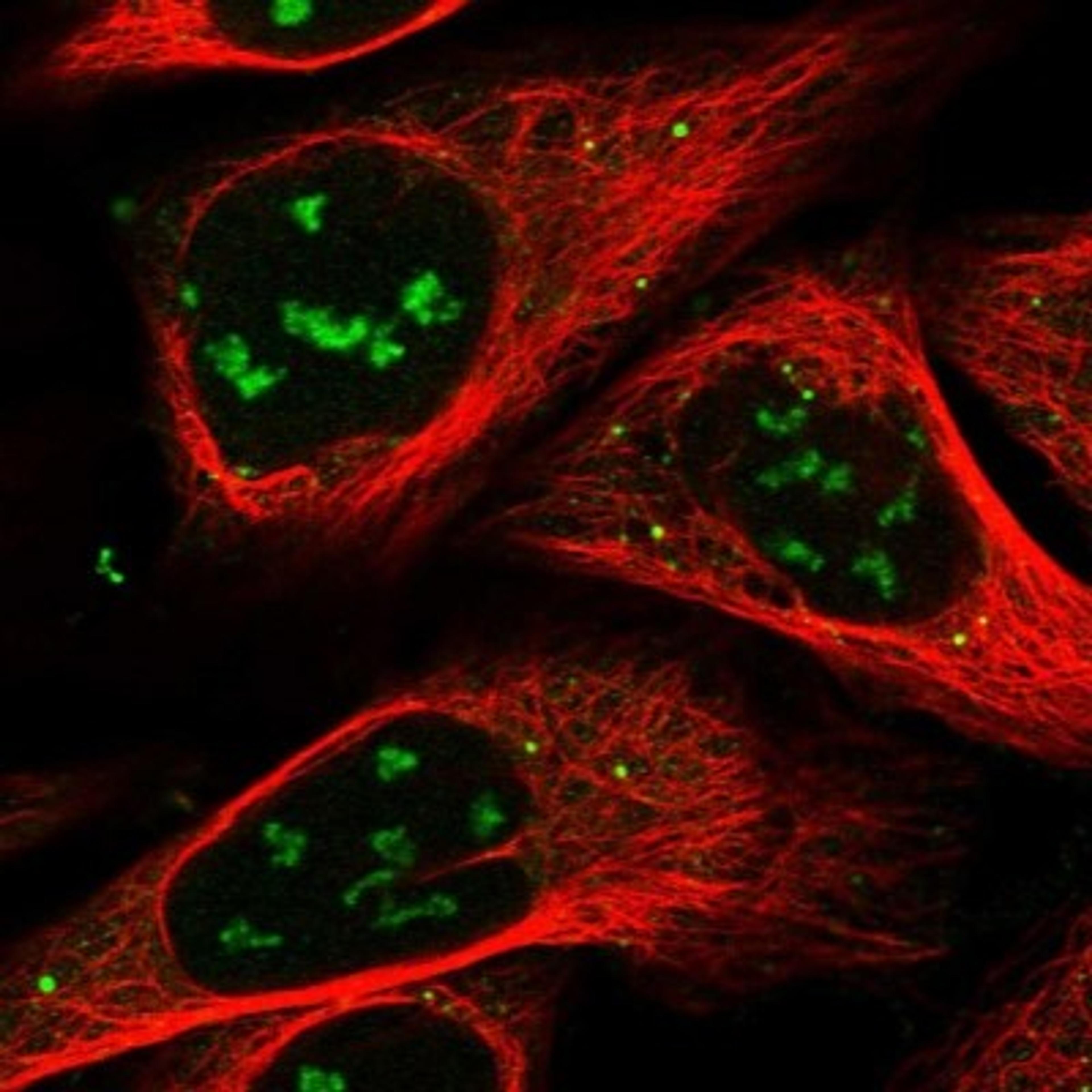 Immunocytochemistry/Immunofluorescence: NADKD1 Antibody [NBP1-83547] - Staining of human cell line U-2 OS shows positivity in nucleoli & vesicles.