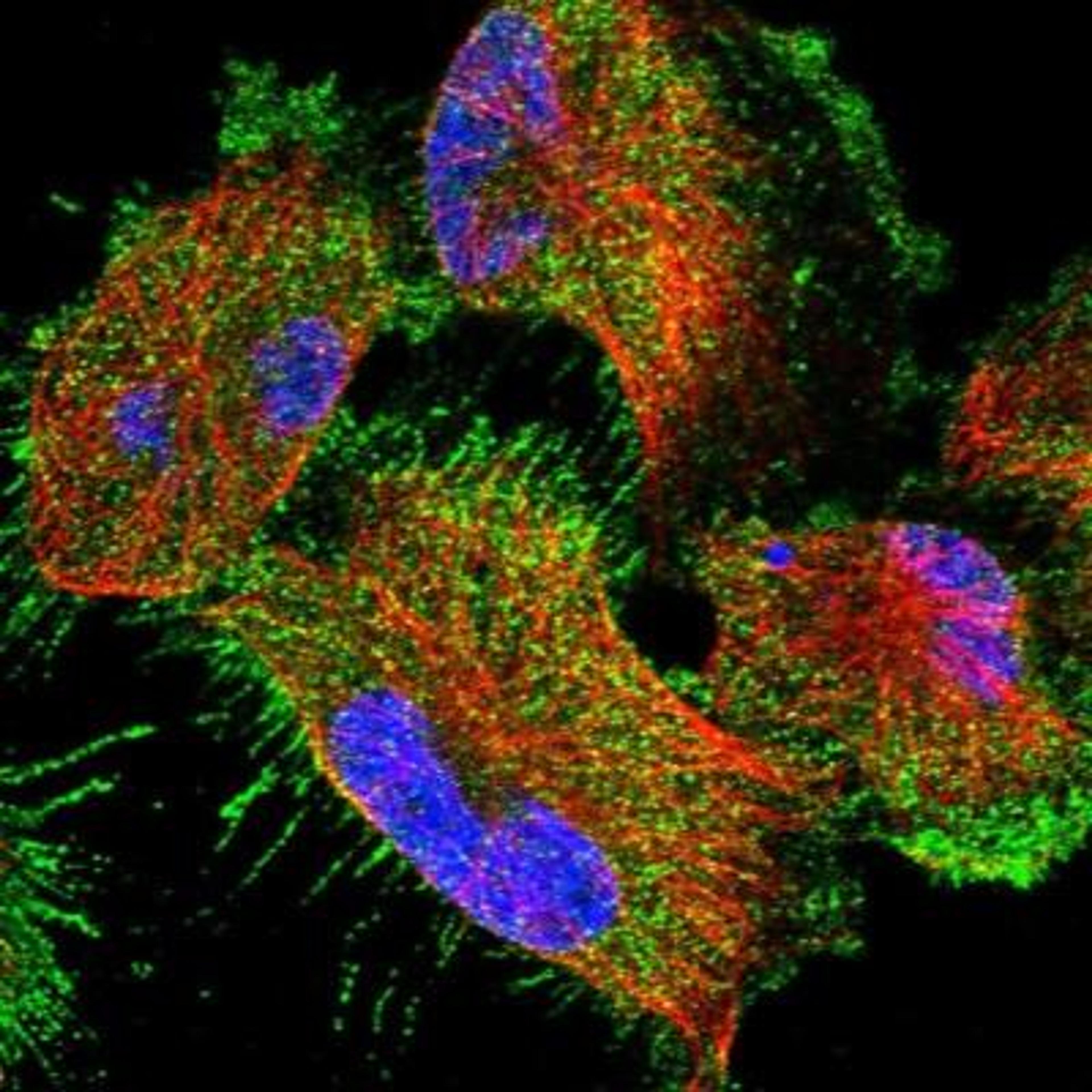 Immunofluorescence: CCDC115 Antibody [NBP1-86568] -  Immunofluorescent staining of human cell line U-251MG shows positivity in plasma membrane.