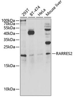 Western blot - RARRES2 antibody (A6963)