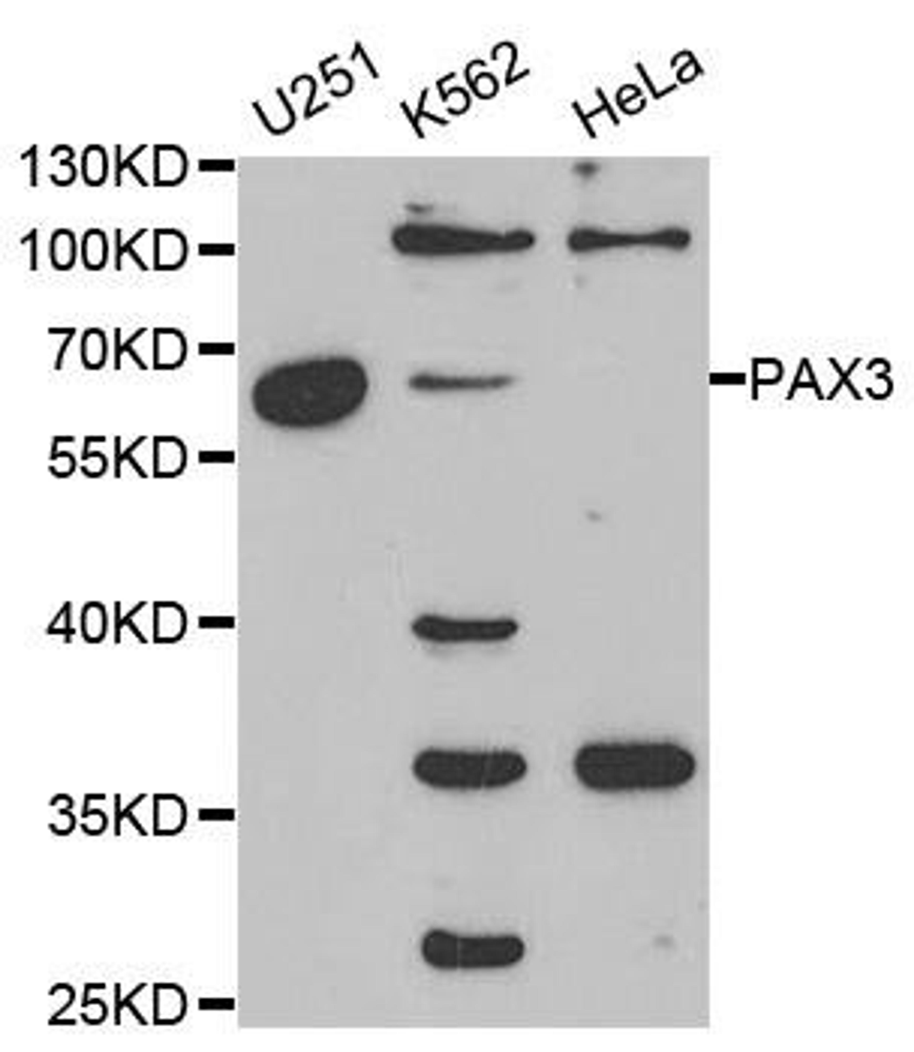 Western blot analysis of extracts of various cell lines using PAX3 antibody