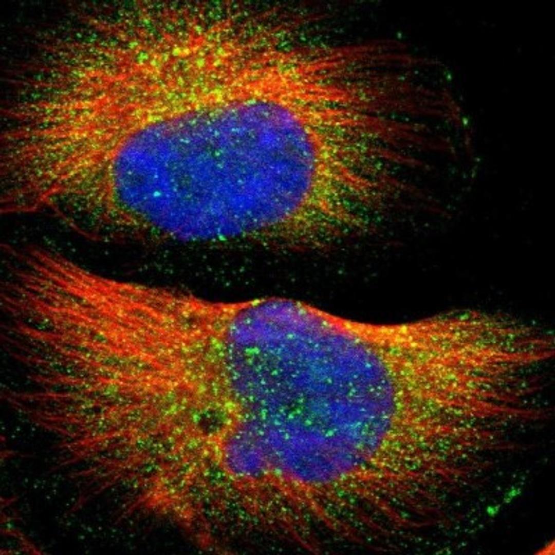 Immunofluorescence: WASH3P Antibody [NBP1-90464] - Staining of human cell line U-251MG shows positivity in vesicles.