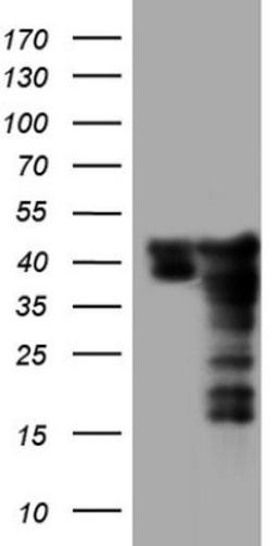 Western Blot: SUMO Activating Enzyme E1 (SAE1) Antibody (6B11) [NBP2-45683] - Analysis of HEK293T cells were transfected with the pCMV6-ENTRY control (Left lane) or pCMV6-ENTRY SUMO Activating Enzyme E1.