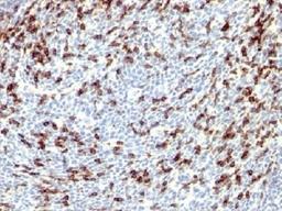 IHC testing of FFPE human tonsil with PD1 antibody. Required HIER: steam sections in 10mM Tris with 1mM EDTA, pH 9.0, for 10-20 min.