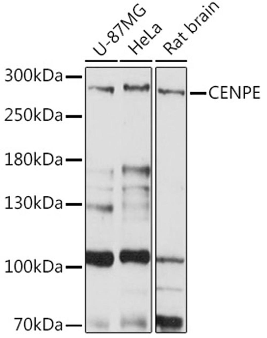 Western blot - CENPE Rabbit pAb (A15263)