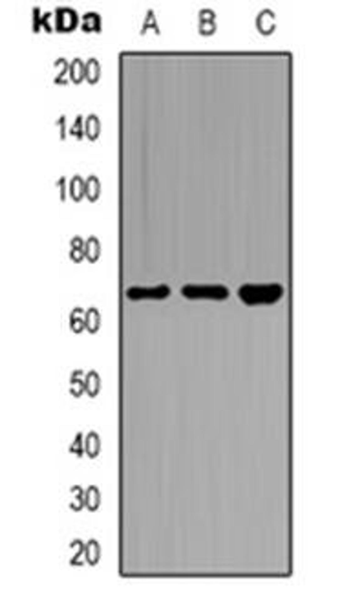 Western blot analysis of CstF-64T expression in Hela (Lane 1), PC3 (Lane 2), MCF7 (Lane 3) whole cell lysates using CSTF2T antibody