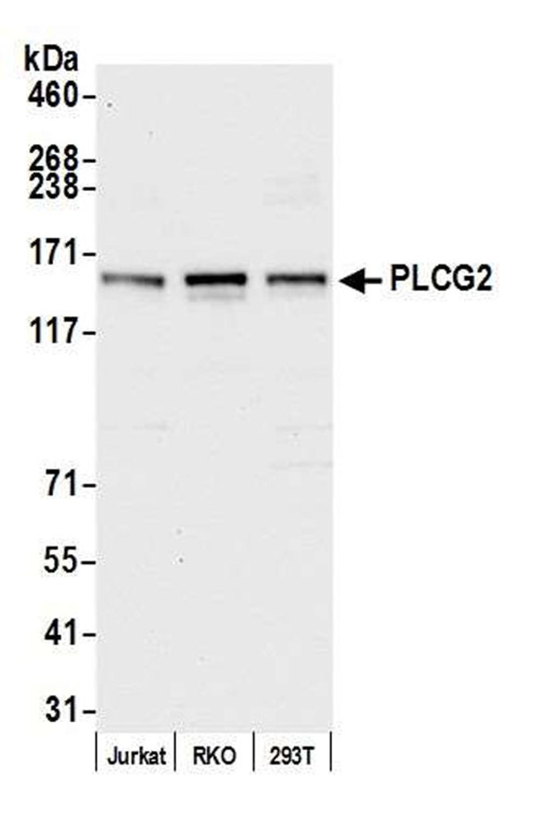 Detection of human PLCG2 by WB.