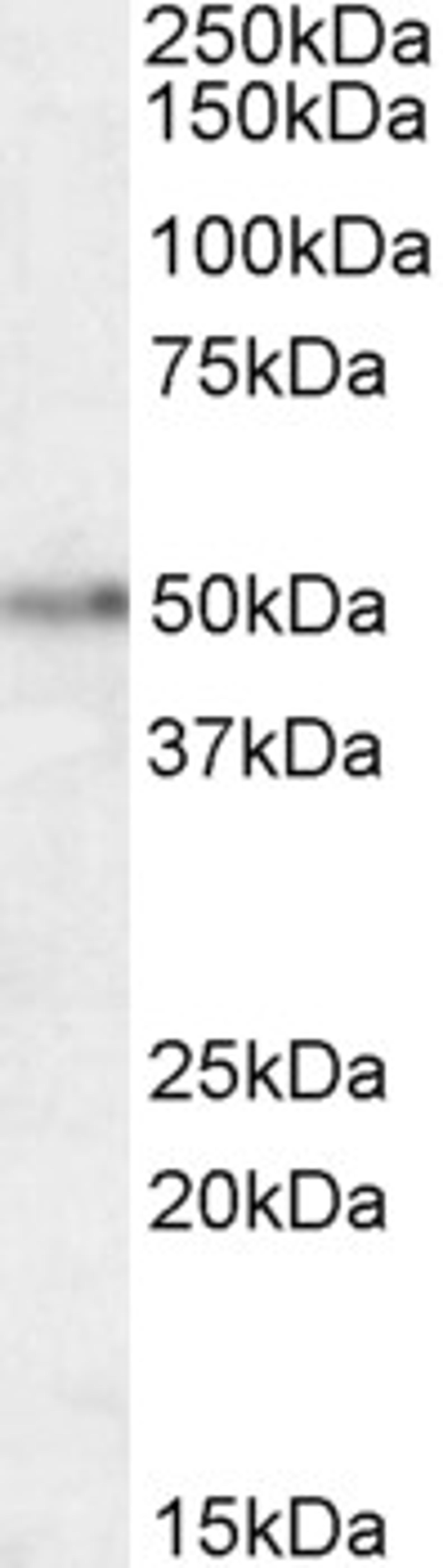 46-104 (1.5ug/ml) staining of Human Brain (Hippocampus) lysate (35ug protein in RIPA buffer). Primary incubation was 1 hour. Detected by chemiluminescence.