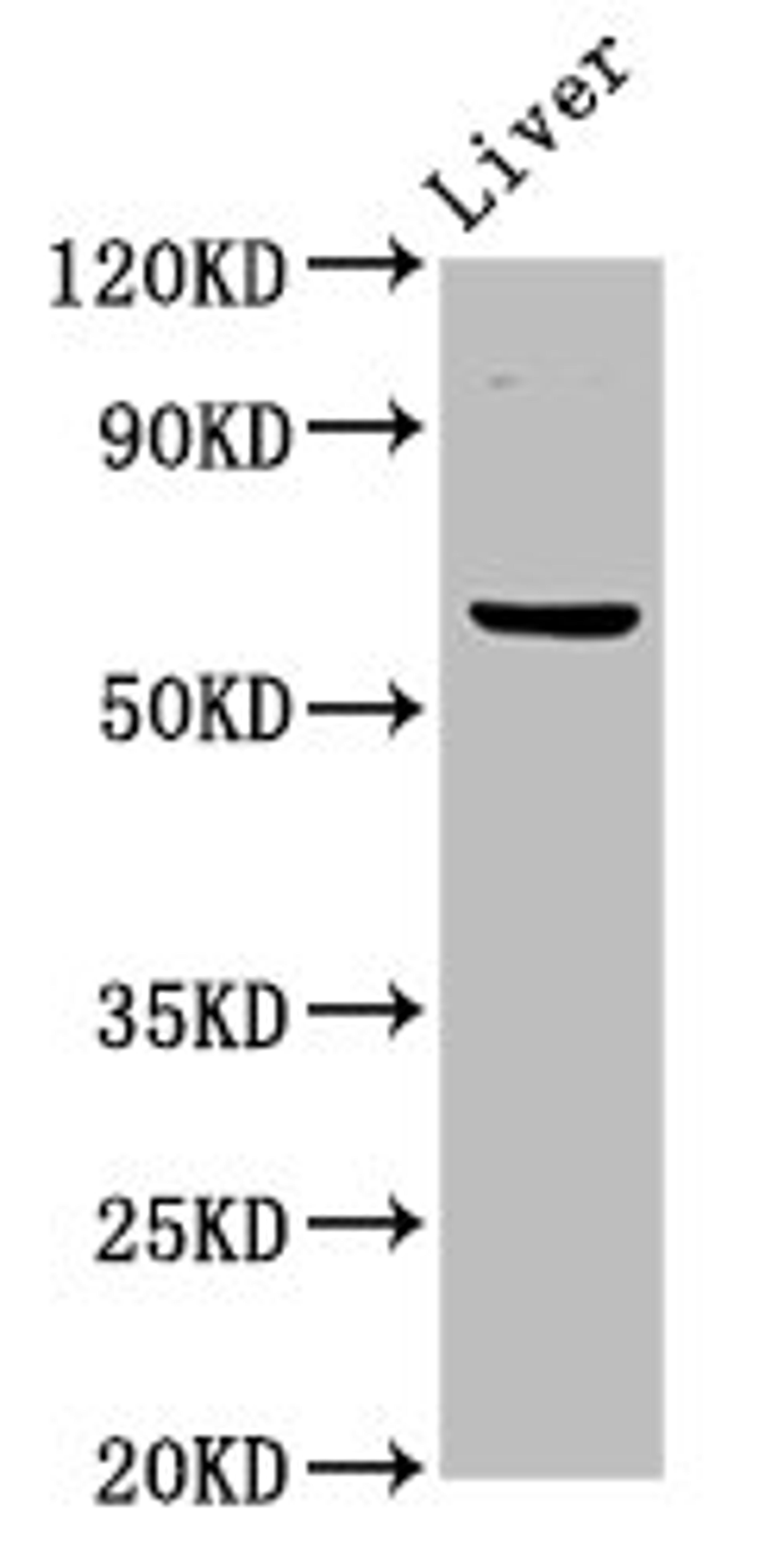 Western Blot. Positive WB detected in: Mouse liver tissue. All lanes: NT5C2 antibody at 3ug/ml. Secondary. Goat polyclonal to rabbit IgG at 1/50000 dilution. Predicted band size: 65, 62 kDa. Observed band size: 65 kDa.