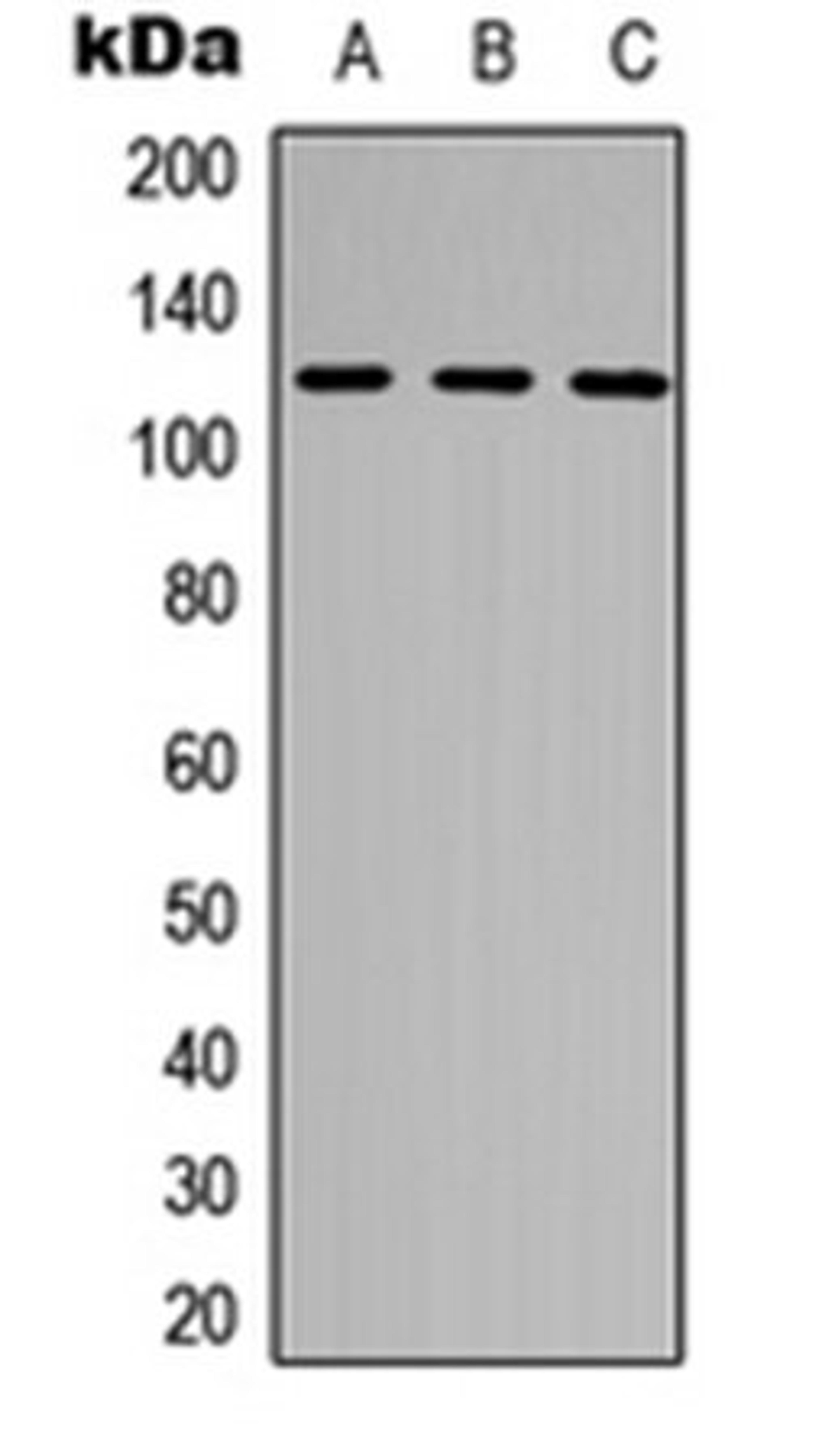 Western blot analysis of THP1 (Lane 1), HepG2 (Lane 2), Hela (Lane 3) whole cell lysates using NEK9 (Phospho-T210) antibody