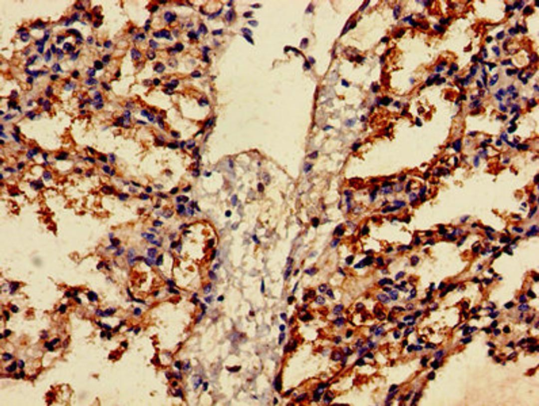 Immunohistochemistry of paraffin-embedded human lung tissue using CSB-PA008605LA01HU at dilution of 1:100