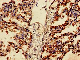 Immunohistochemistry of paraffin-embedded human lung tissue using CSB-PA008605LA01HU at dilution of 1:100