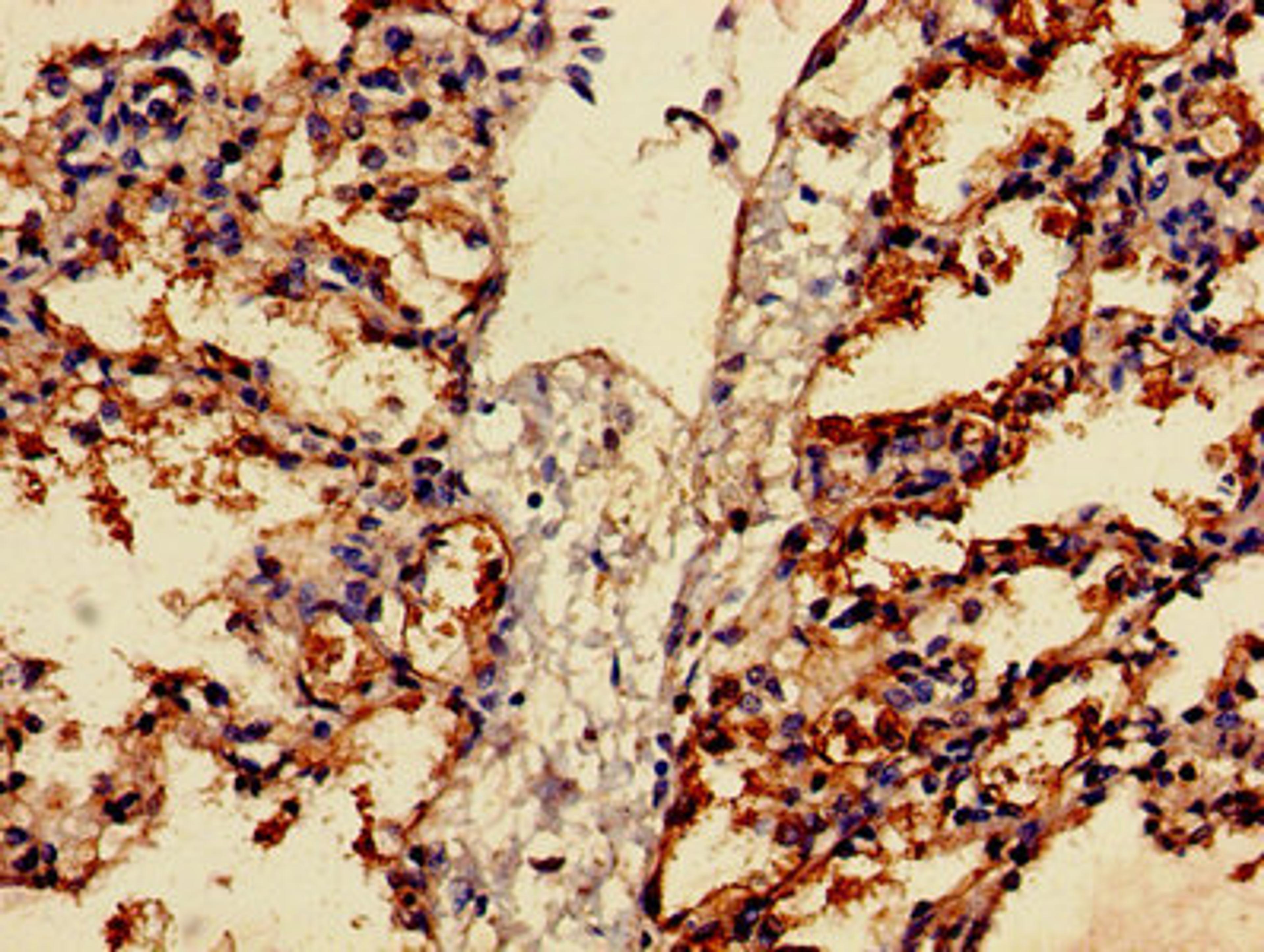 Immunohistochemistry of paraffin-embedded human lung tissue using CSB-PA008605LA01HU at dilution of 1:100