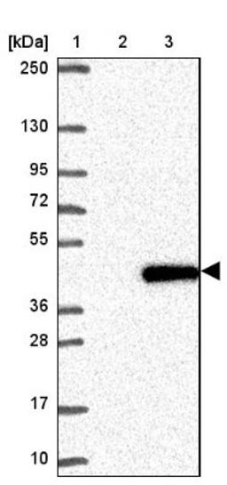 Western Blot: NT5C3 Antibody [NBP2-38124] - Lane 1: Marker [kDa] 250, 130, 95, 72, 55, 36, 28, 17, 10<br/>Lane 2: Negative Control<br/>Lane 3: LY413931