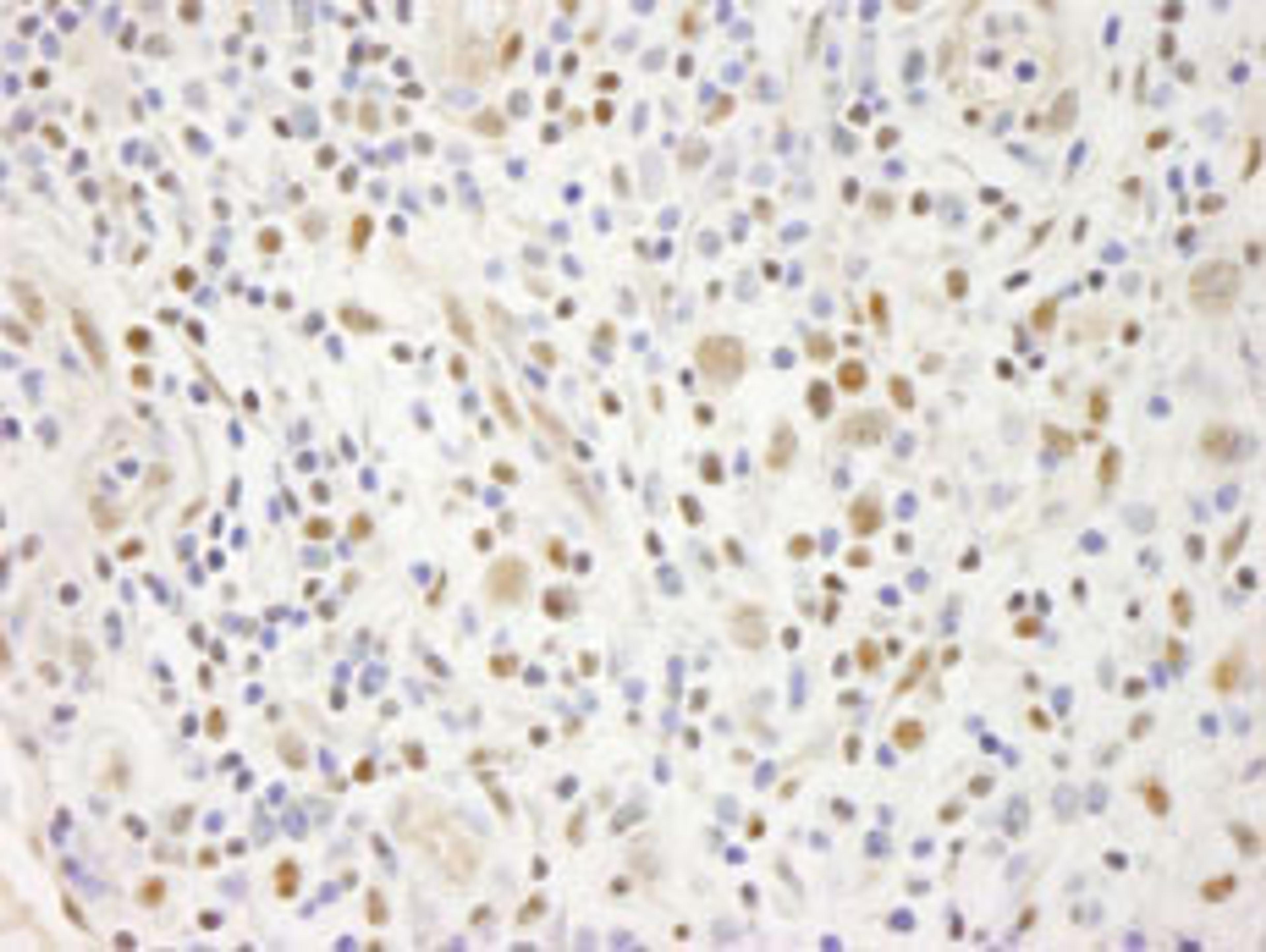 Detection of human ELF1 immunohistochemistry.