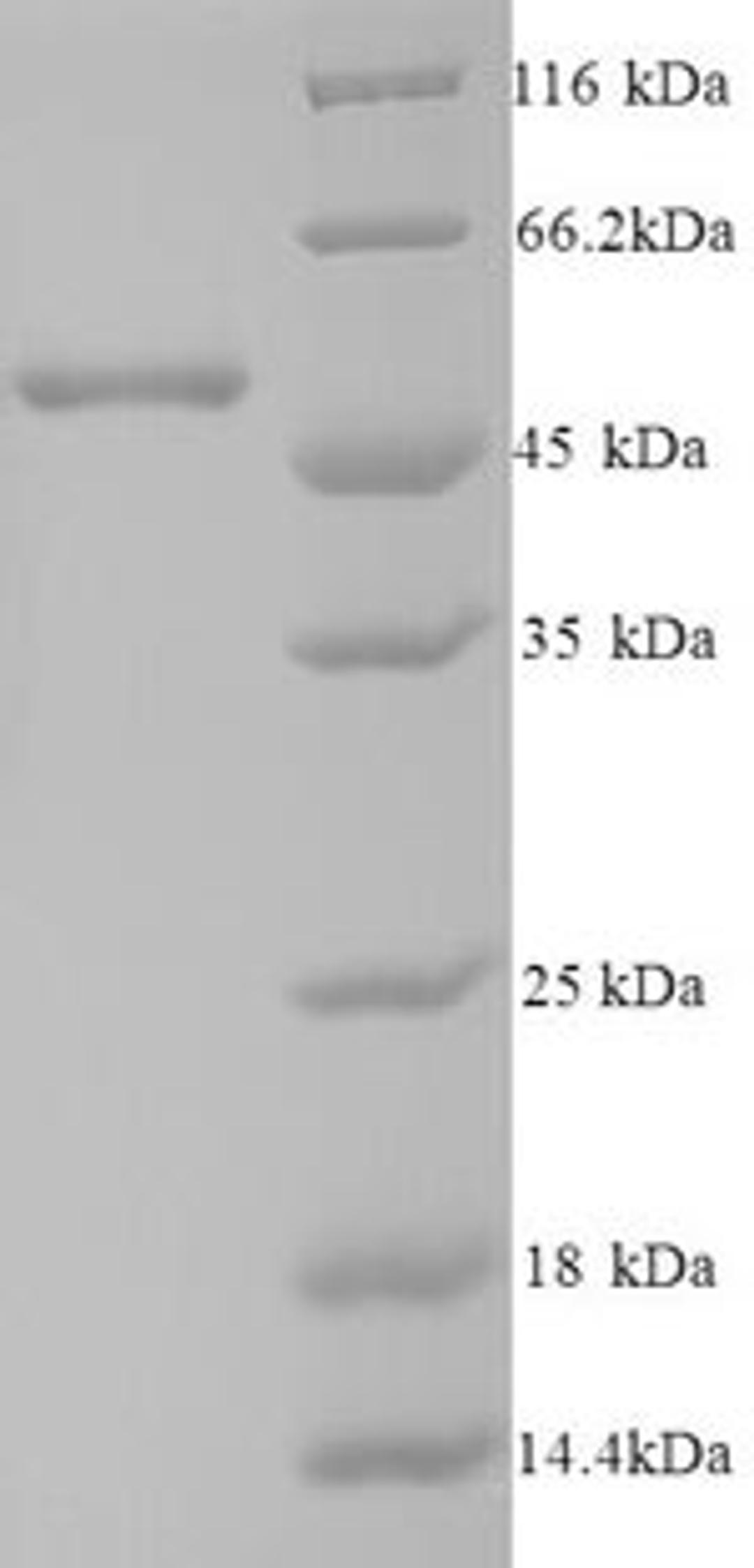 (Tris-Glycine gel) Discontinuous SDS-PAGE (reduced) with 5% enrichment gel and 15% separation gel.