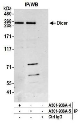 Detection of human Dicer by western blot of immunoprecipitates.