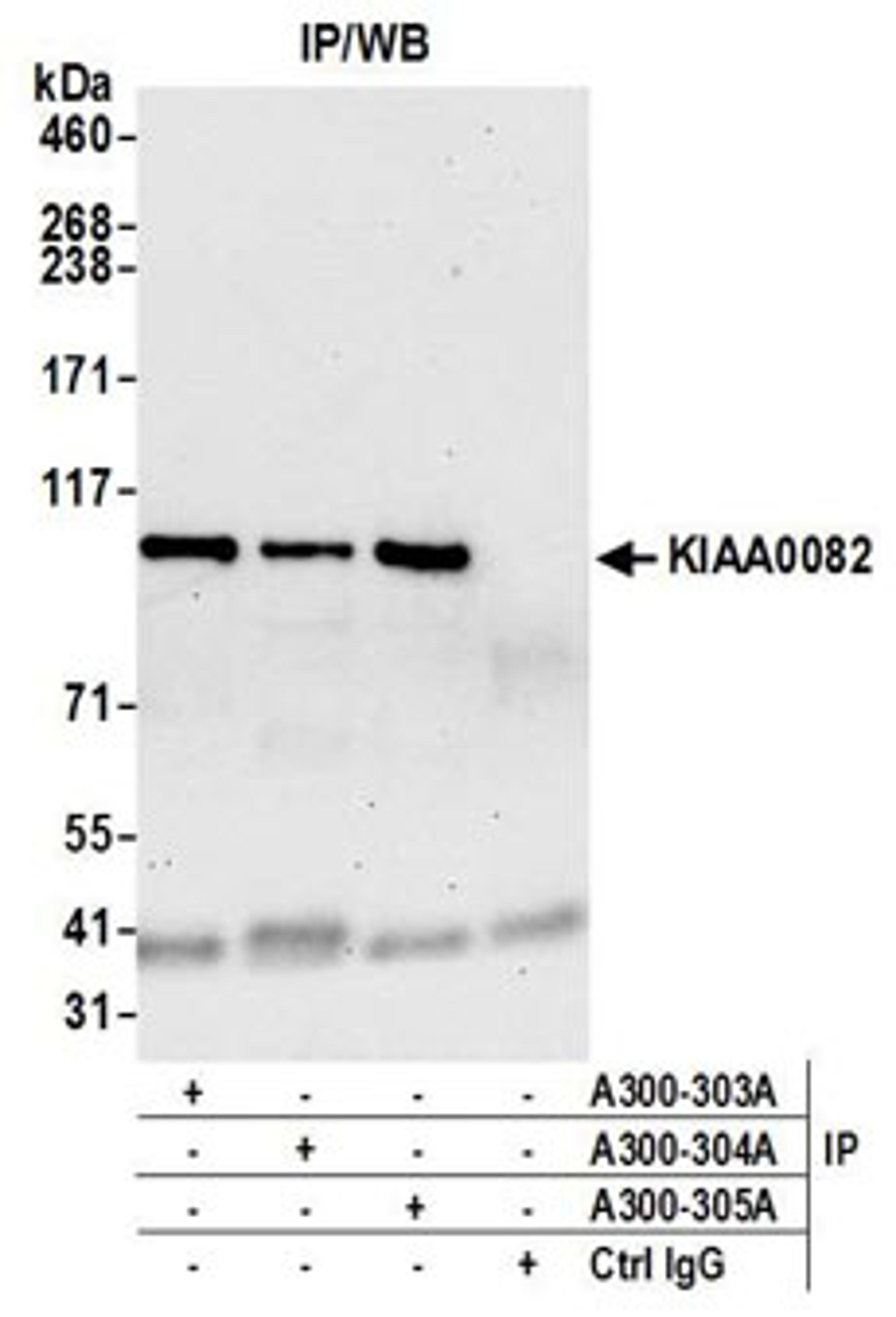 Detection of human KIAA0082 by western blot of immunoprecipitates.