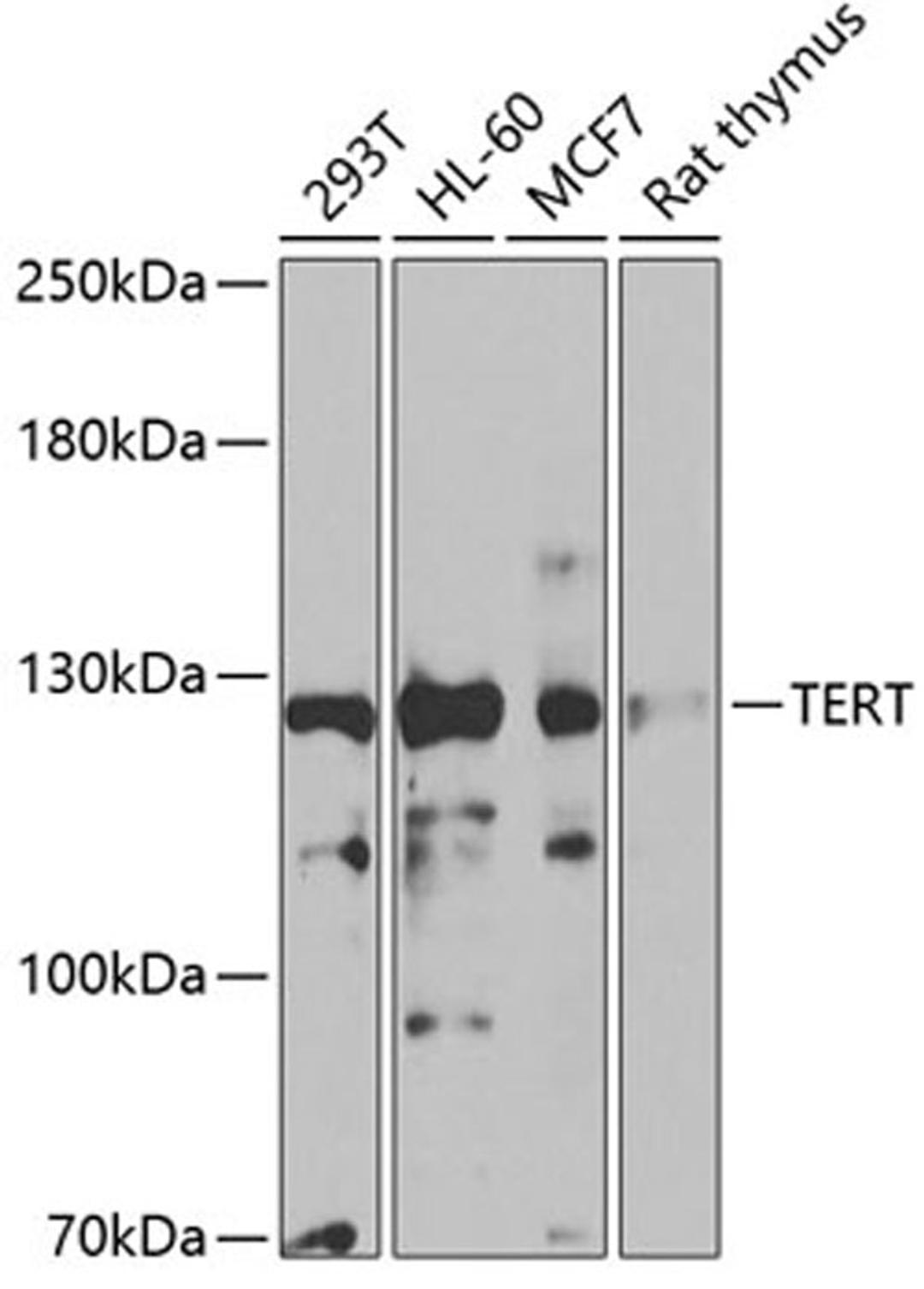 Western blot - TERT antibody (A2979)
