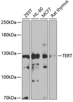 Western blot - TERT antibody (A2979)
