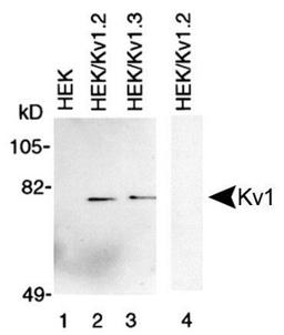 Western Blot: Kv1 Antibody [NBP1-42788] - Membrane preparations from HEK-293 cells untransfected (lane 1) transfected with Kv1.2 (lanes 2 and 4) and transfected with Kv1.3 (lane 3) were subjected to 10% SDS-PAGE and were Western blotted with Kv1 Antibody (NBP1-42788). Lane 4 was probed with NBP1-42788 that had been preincubated with the peptide used to generate NBP1-42788.