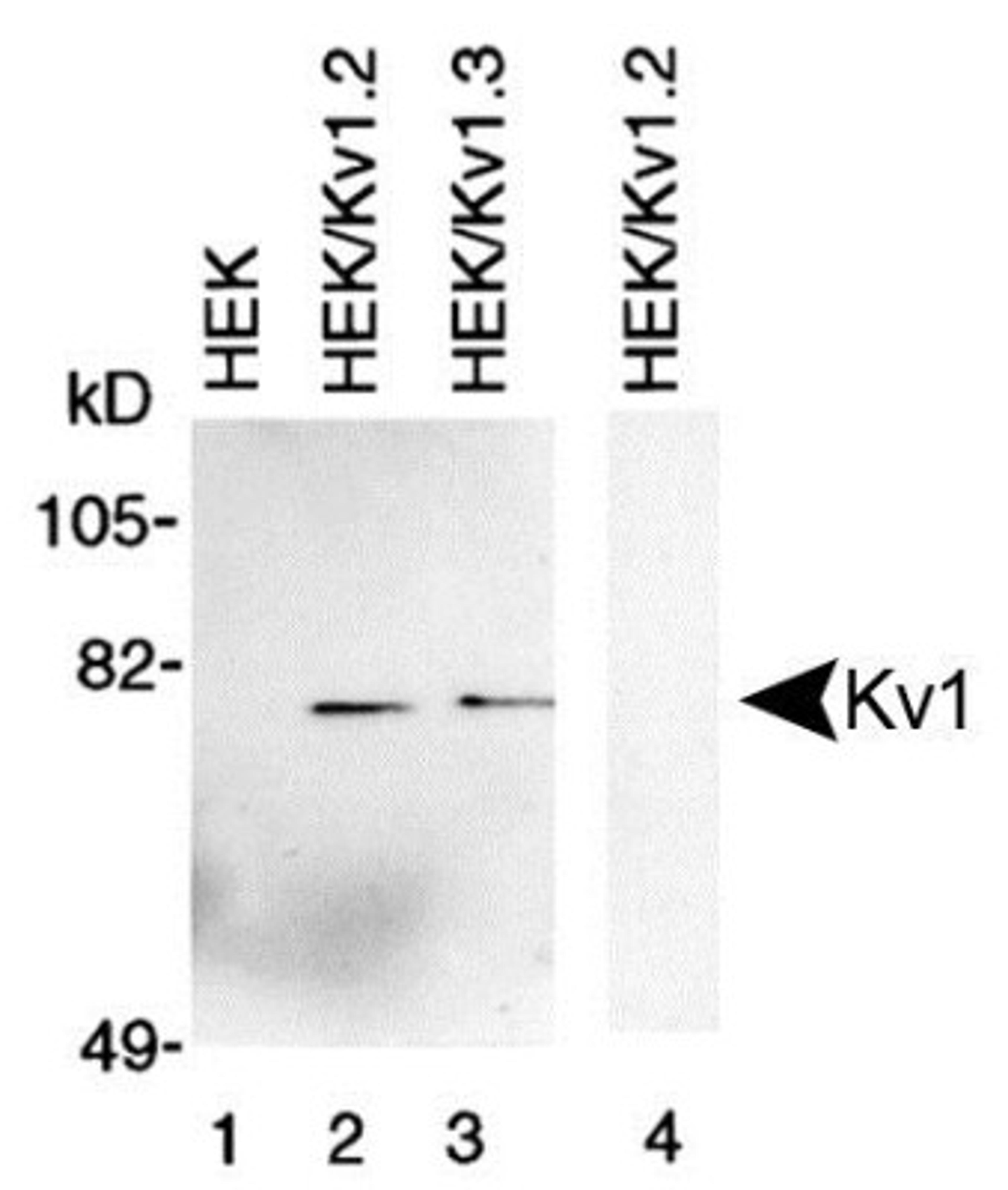 Western Blot: Kv1 Antibody [NBP1-42788] - Membrane preparations from HEK-293 cells untransfected (lane 1) transfected with Kv1.2 (lanes 2 and 4) and transfected with Kv1.3 (lane 3) were subjected to 10% SDS-PAGE and were Western blotted with Kv1 Antibody (NBP1-42788). Lane 4 was probed with NBP1-42788 that had been preincubated with the peptide used to generate NBP1-42788.