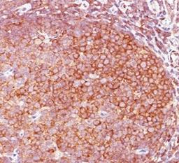 IHC staining of human tonsil with Bcl10 antibody (BL10/411).