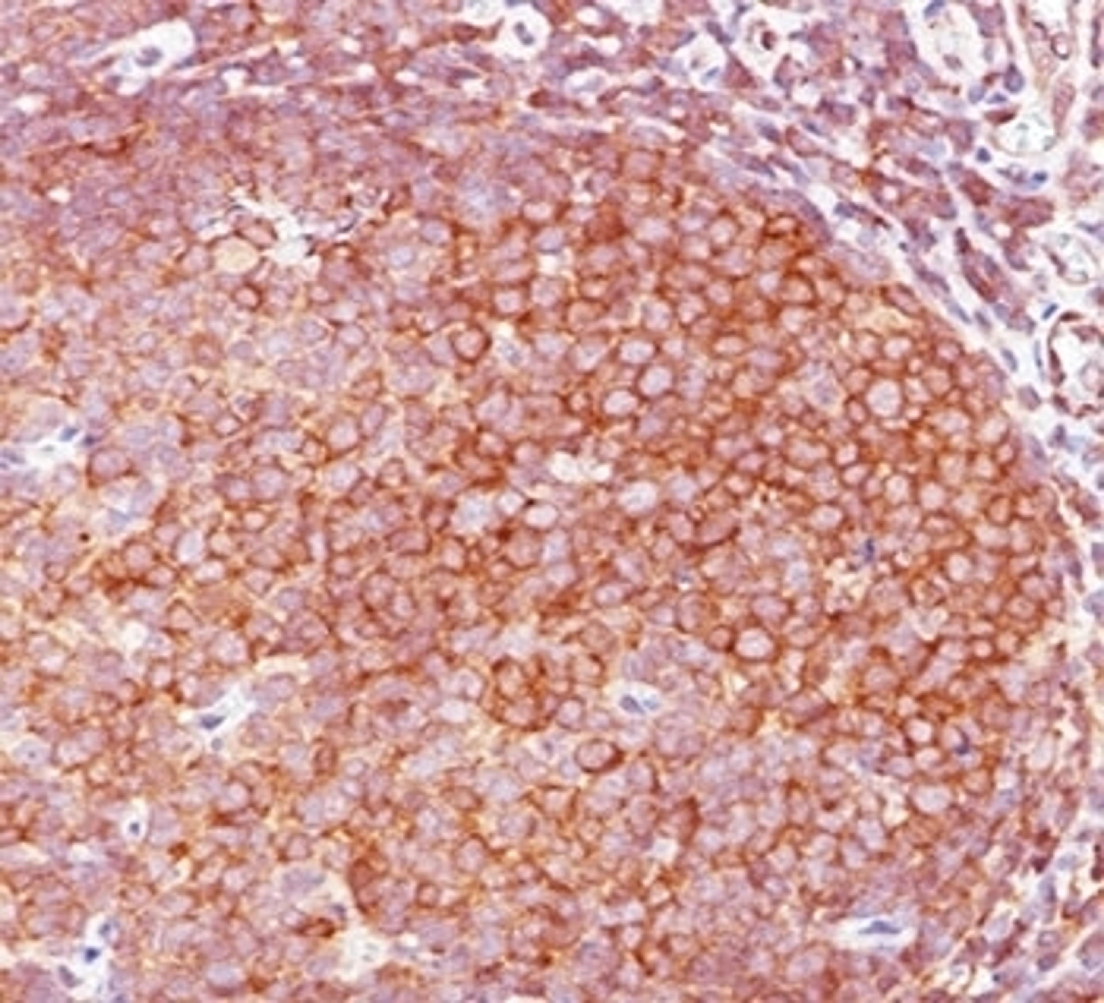 IHC staining of human tonsil with Bcl10 antibody (BL10/411).