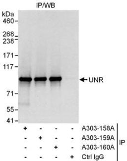 Detection of human UNR by western blot of immunoprecipitates.