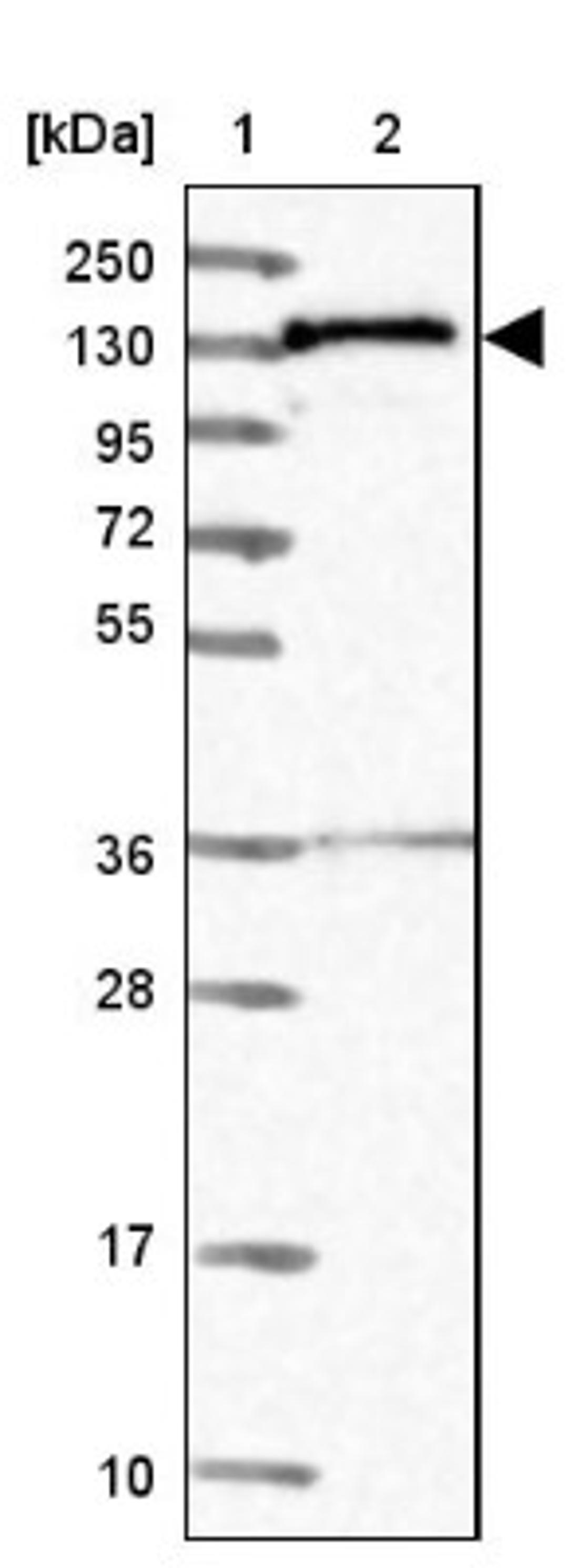 Western Blot: NARG1L Antibody [NBP1-92167] - Lane 1: Marker [kDa] 250, 130, 95, 72, 55, 36, 28, 17, 10<br/>Lane 2: Human cell line RT-4