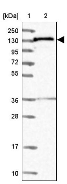 Western Blot: NARG1L Antibody [NBP1-92167] - Lane 1: Marker [kDa] 250, 130, 95, 72, 55, 36, 28, 17, 10<br/>Lane 2: Human cell line RT-4