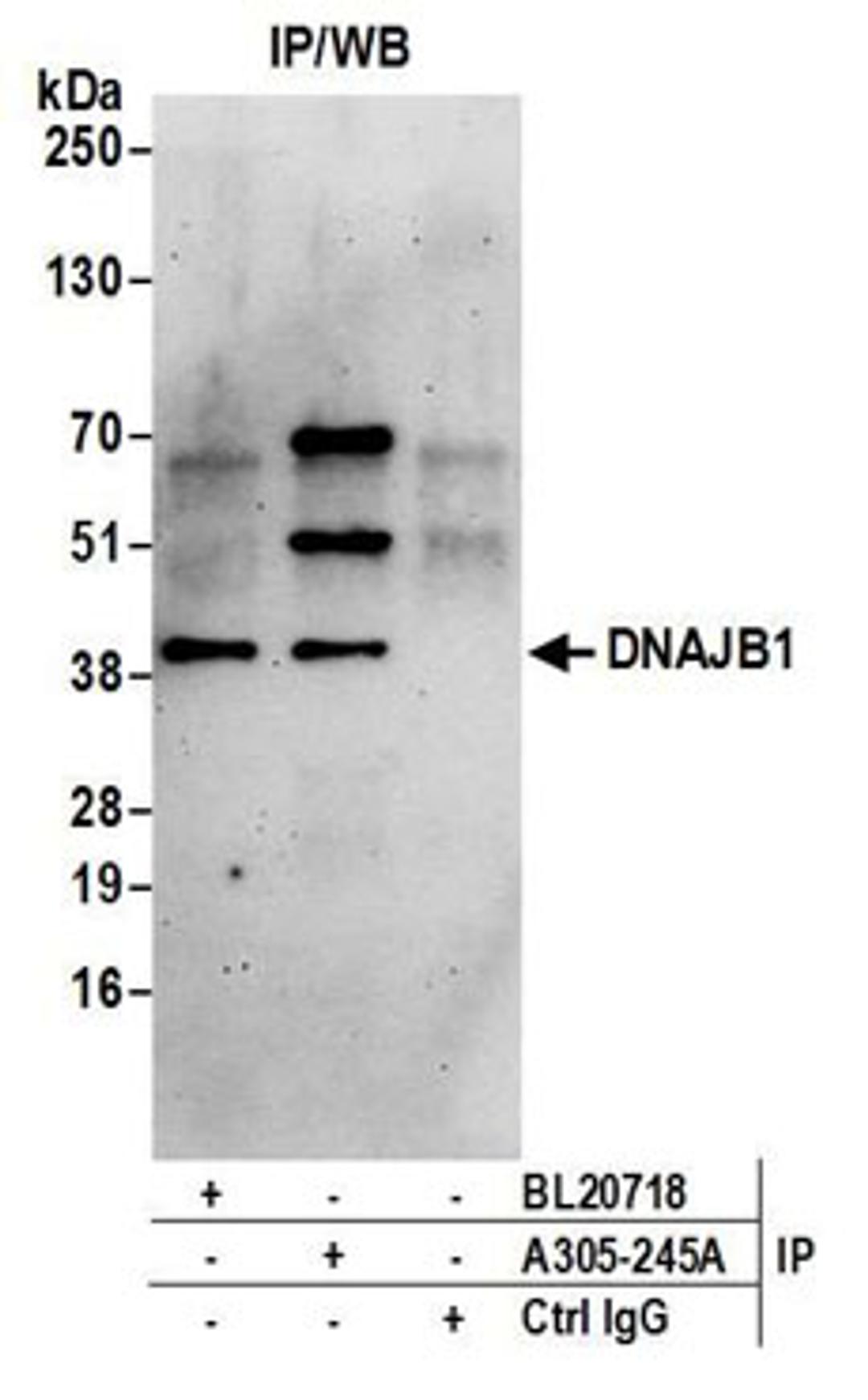 Detection of human DNAJB1 by western blot of immunoprecipitates.