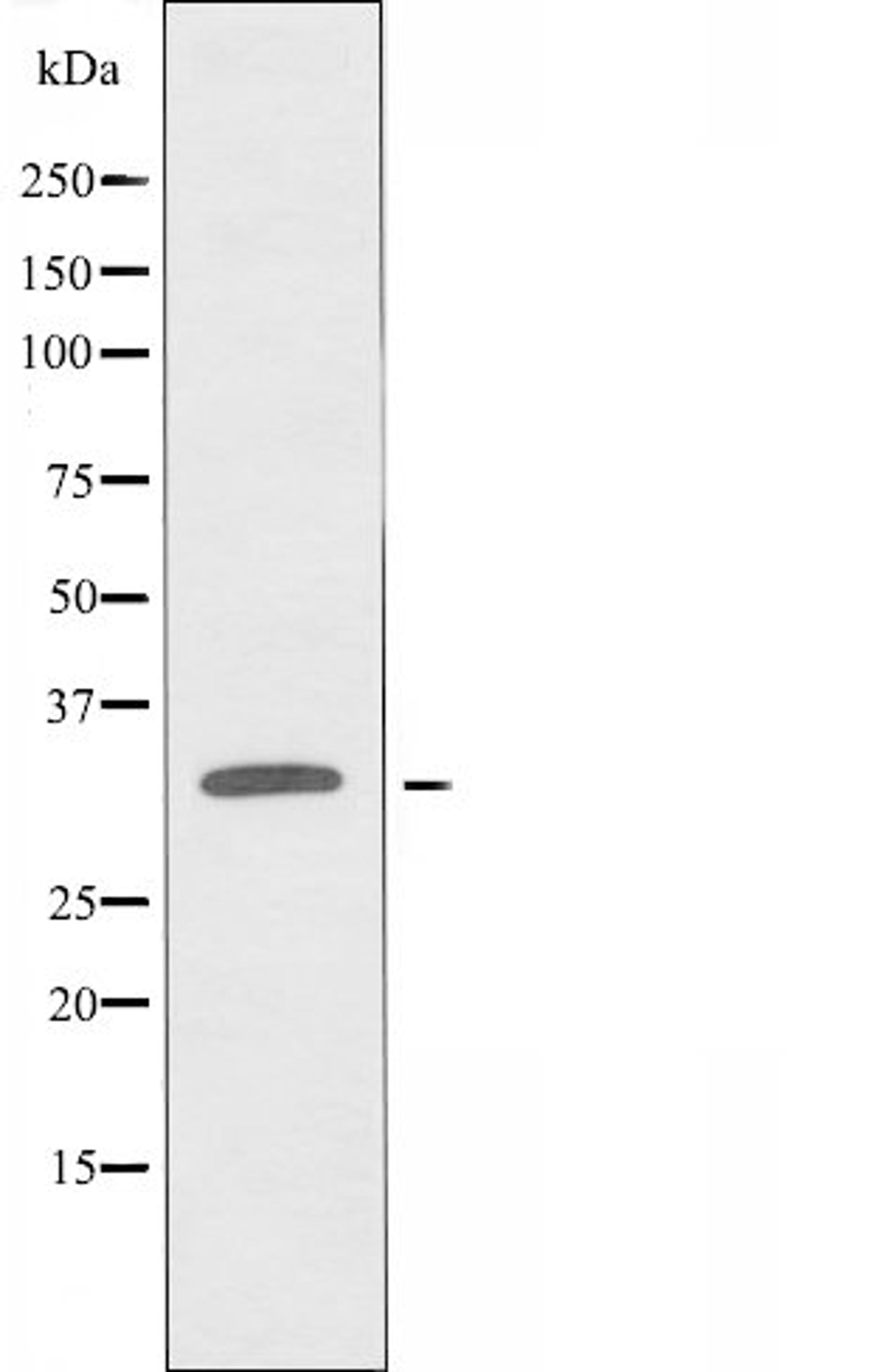 Western blot analysis of LOVO cells using OR8K3 antibody