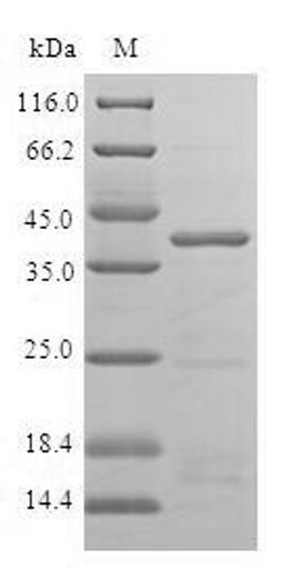 (Tris-Glycine gel) Discontinuous SDS-PAGE (reduced) with 5% enrichment gel and 15% separation gel.