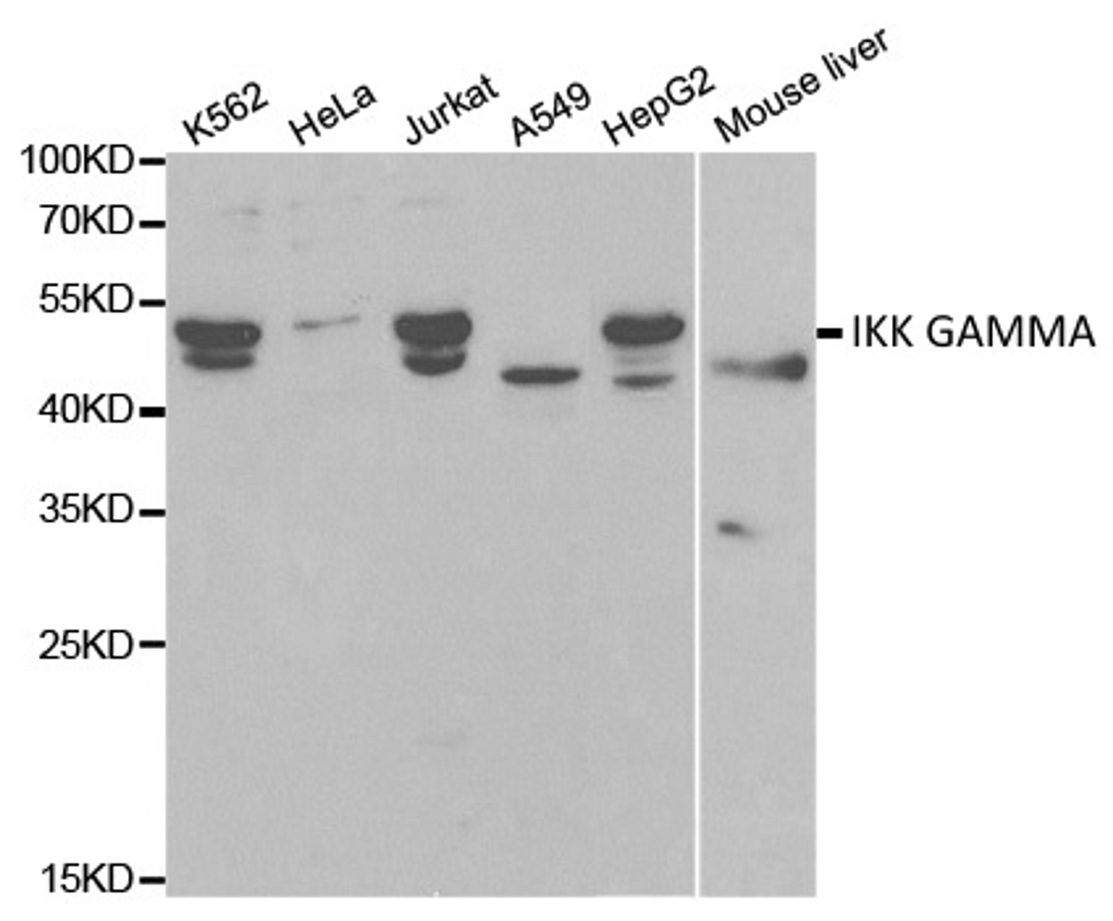 Western blot analysis of cell and tissue lysates using Rabbit anti IKK gamma antibody