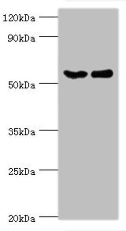 Western blot. All lanes: CSTF2 antibody at 6ug/ml. Lane 1: Hela whole cell lysate. Lane 2: Jurkat whole cell lysate. Secondary. Goat polyclonal to rabbit IgG at 1/10000 dilution. Predicted band size: 61, 60 kDa. Observed band size: 61 kDa. 