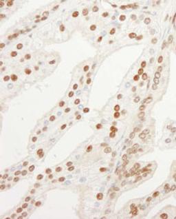 Detection of human KPNA4 by immunohistochemistry.