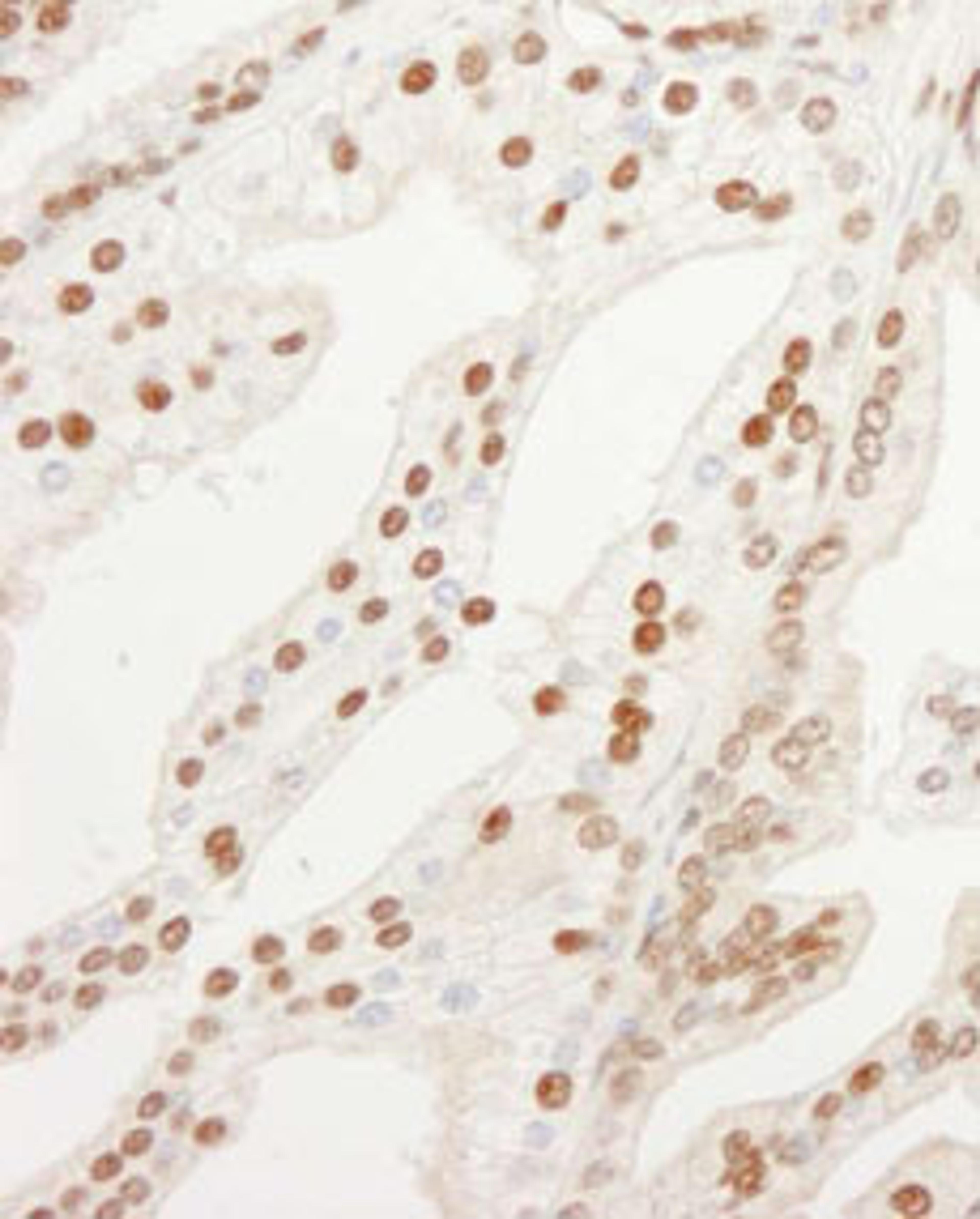 Detection of human KPNA4 by immunohistochemistry.