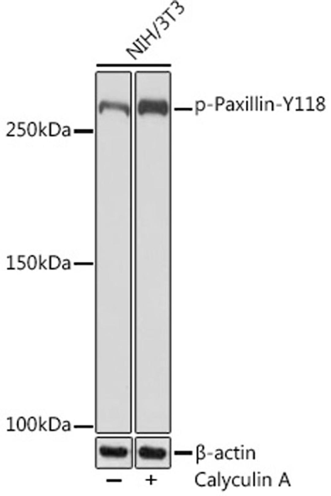 Western blot - Phospho-LRRK2-S935 Rabbit mAb (AP1154)