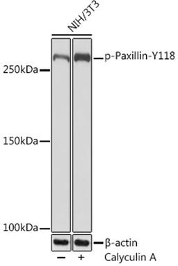 Western blot - Phospho-LRRK2-S935 Rabbit mAb (AP1154)