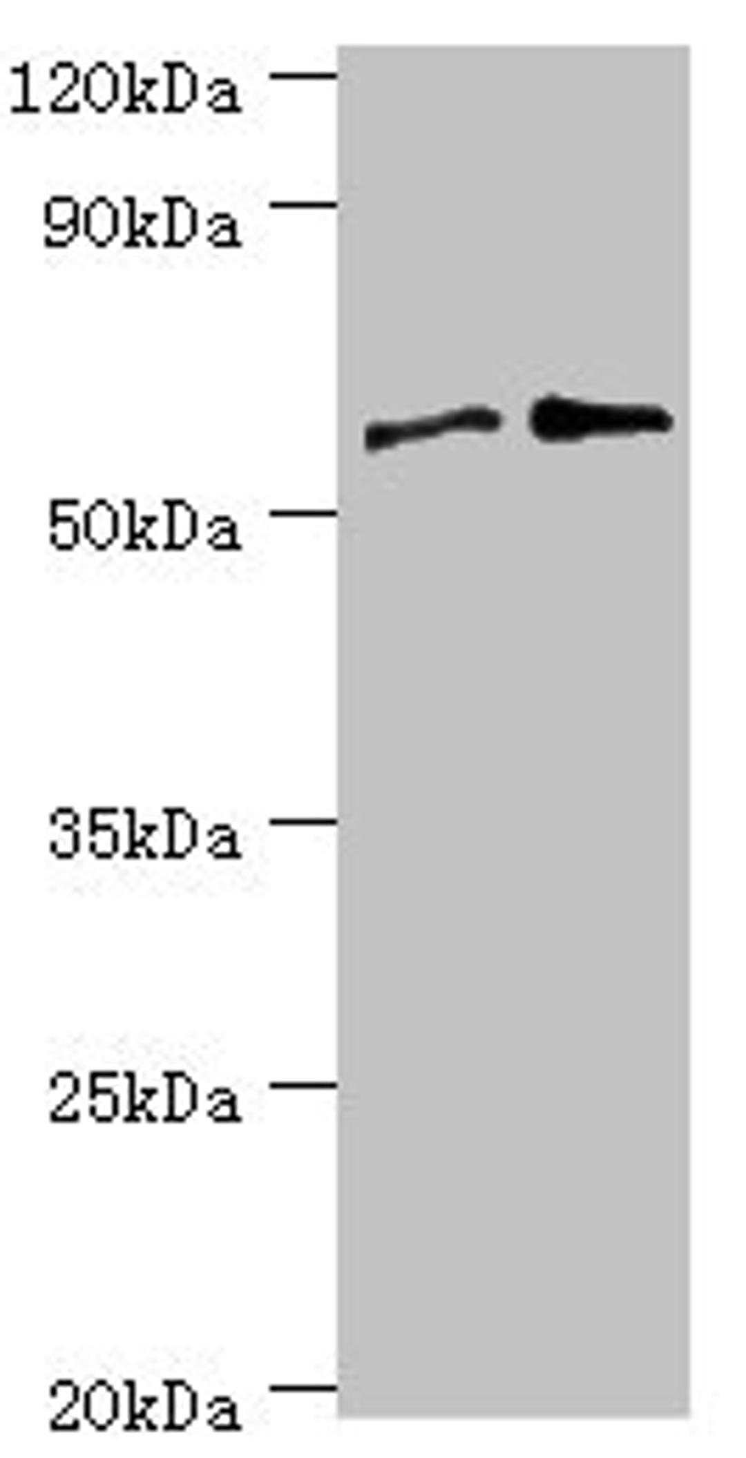Western blot. All lanes: Serine/threonine-protein phosphatase 2B catalytic subunit gamma isoform antibody at 8ug/ml. Lane 1: Rat brain tissue. Lane 2: MCF-7 whole cell lysate. Secondary. Goat polyclonal to rabbit IgG at 1/10000 dilution. Predicted band size: 59, 58, 60 kDa. Observed band size: 59 kDa. 
