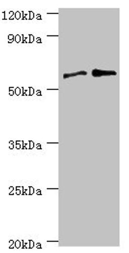 Western blot. All lanes: Serine/threonine-protein phosphatase 2B catalytic subunit gamma isoform antibody at 8ug/ml. Lane 1: Rat brain tissue. Lane 2: MCF-7 whole cell lysate. Secondary. Goat polyclonal to rabbit IgG at 1/10000 dilution. Predicted band size: 59, 58, 60 kDa. Observed band size: 59 kDa. 